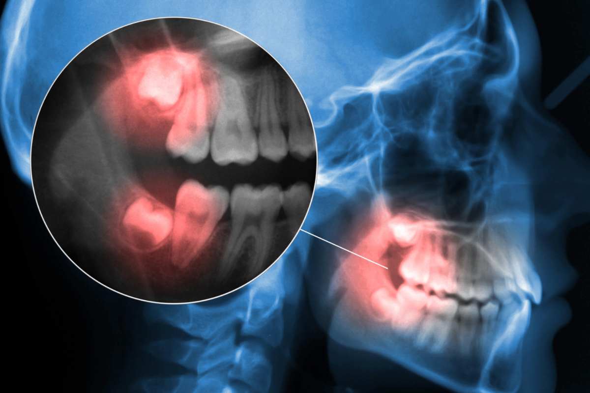 Come non rischiare quando si lavano i denti